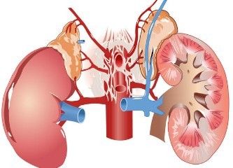 cin # 72_kidney